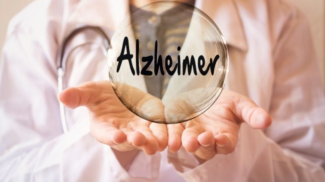 Lo que debes saber sobre el Alzheimer…